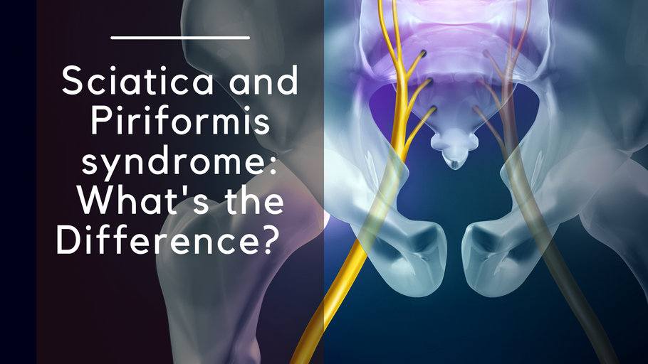 Sciatica and Piriformis syndrome: What's the Difference?